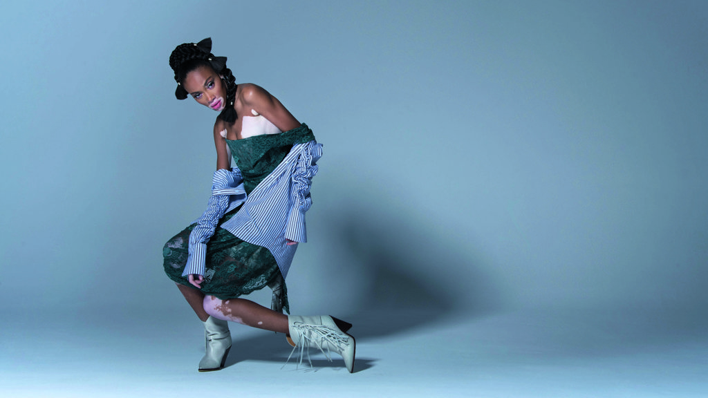 Winnie Harlow: nová tvář krásy Winnie Harlow: nová tvář krásy
