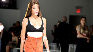 Seznamte se s Winnie Harlow, novou modelkou Victoria`s Secret