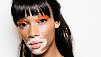  

Winnie Harlow
