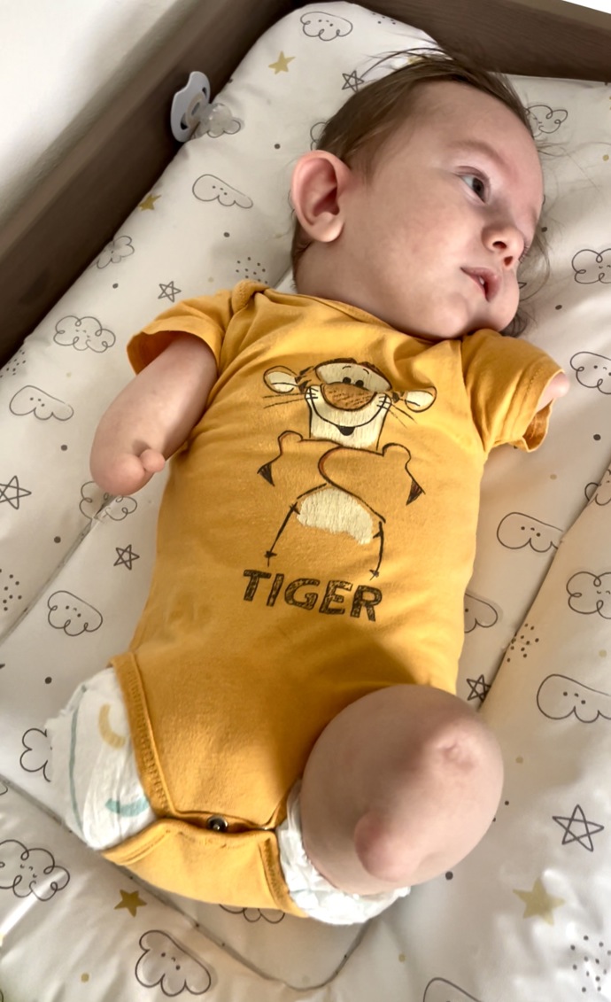 Během těhotenství nic nenasvědčovalo tomu, že by se chlapec mohl narodit s vrozenou vadou.