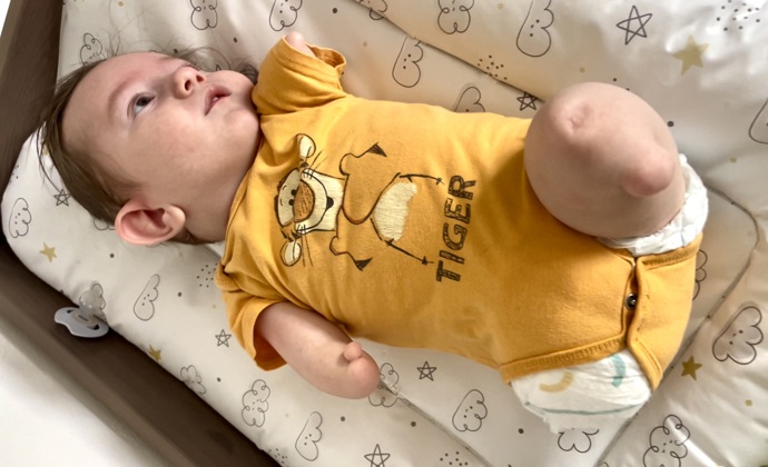 Rodiče by si pro Maxíka moc přáli robotické ruce, které by mu pomohly držet předměty, přetáčet se a učit se běžným úchopům. 