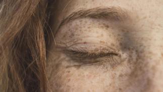 V čem může pomoci dermatologie a jaké zákroky nabízí klinika Asklepion