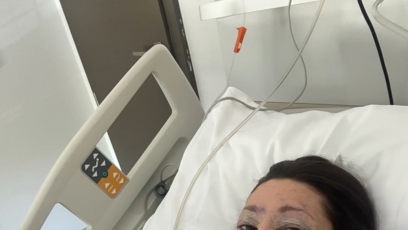 FOTO: Tereza Kerndlová dvě hodiny po operaci víček.