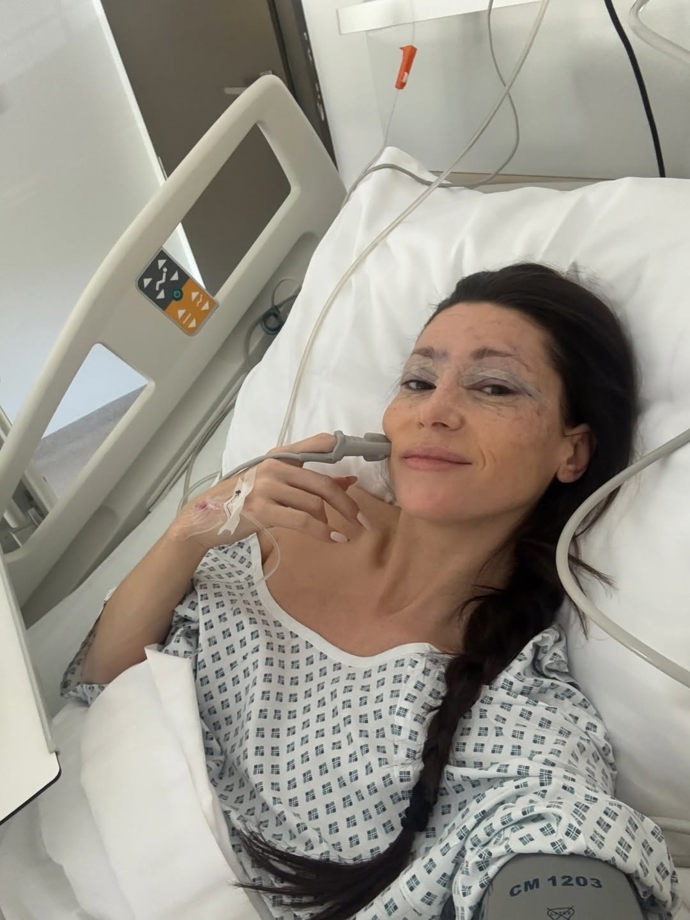 Tereza Kerndlová dvě hodiny po operaci víček. 