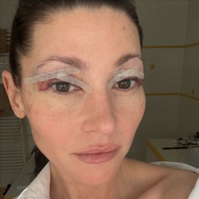 Tereza Kerndlová sdílela fotky před a po.