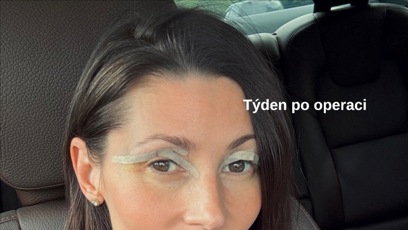 FOTO: Tereza Kerndlová ukázala realitu.