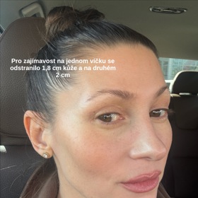 Tereza Kerndlová po operaci. 