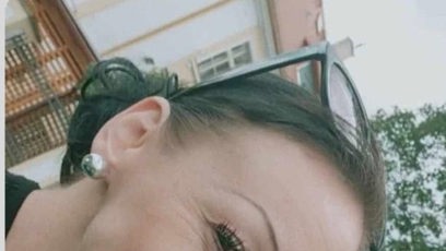FOTO: Tereza uvedla, že při události utrpěla modřinu na noze.